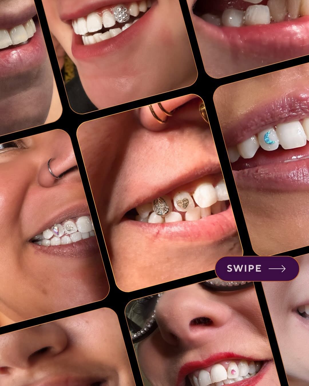 Collage of different examples of tooth gems